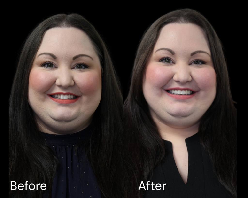 Christine B&A With Words