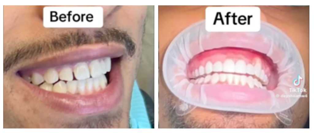 DayShawn before and after